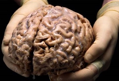 Women's brains appear 'years younger' than men's: study