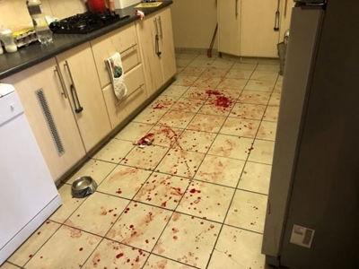 Mother and child attacked on KZN farm