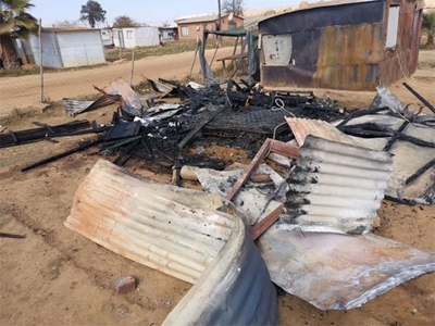 Mamelodi clinic ‘refuses’ to treat severely burnt boy due to Covid-19 patients being ‘prioritised’
