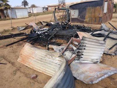 Mamelodi clinic ‘refuses’ to treat severely burnt boy due to Covid-19 patients being ‘prioritised’