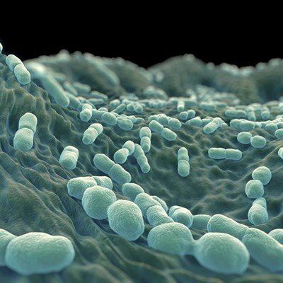 George woman 1 of listeriosis fatalities