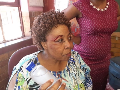 Gauteng teacher assaulted by learner