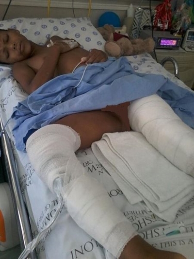 Thehano 'struggling' after dog attack