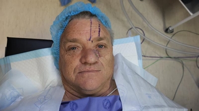 Life-changing nose job for dedicated abuse counsellor