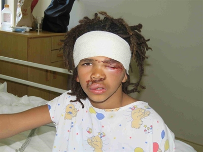Boy run over during by-election rallies