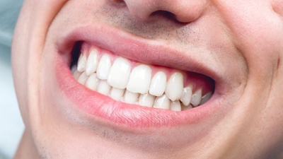 Oral care during cancer treatment