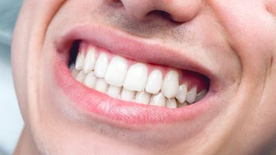 Oral care during cancer treatment