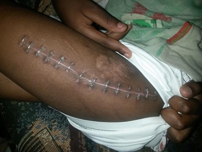 Boys hit by taxi