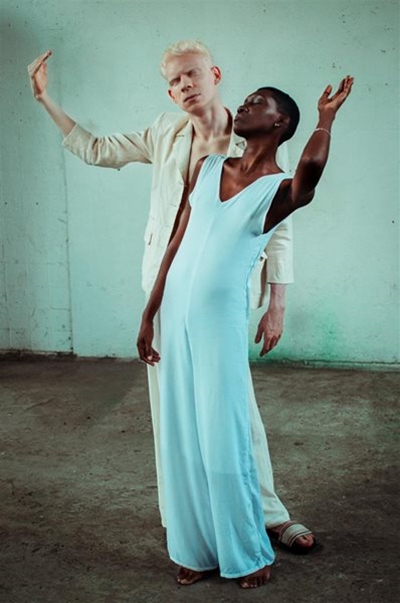 Ending discrimination, ritual killings: What is International Albinism Awareness Day?