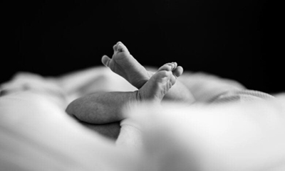 Conjoined twin dies after separation surgery in Limpopo