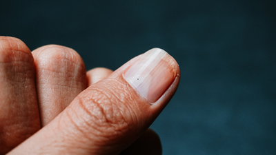 What your nails tell you about your health