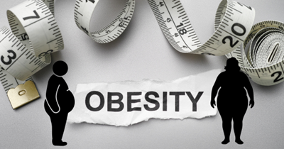 Obesity myths debunked as South Africa faces growing health crisis