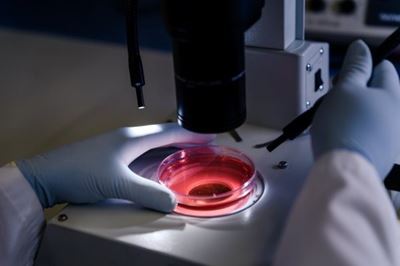 Cord tissue therapies offering new hope for SA patients with chronic disease