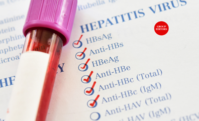 Could you have Hepatitis and not know it? Why awareness could save your life