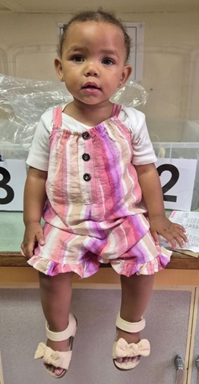 Early intervention gives children with clubfoot the chance to walk, play and thrive