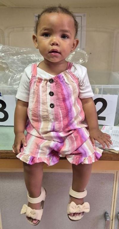 Early intervention gives children with clubfoot the chance to walk, play and thrive
