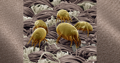 House Dust Mite Allergy:  Why you should be tested
