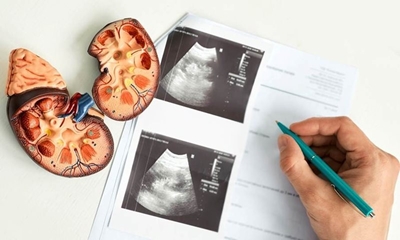 Breakthrough treatments target kidney and heart risk