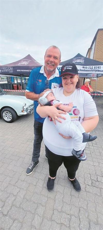 Eerste operasie op klein Caleb suksesvol