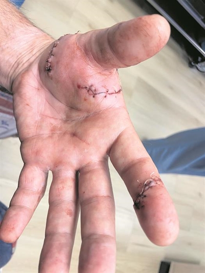 Walks turn risky due to roaming dog attacks in Pacaltsdorp  