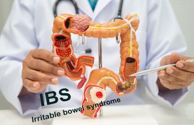 Inflammatory bowel disease: Looking beyond symptoms for better long-term care