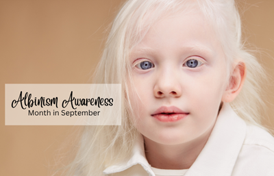 Albinism Awareness Month highlights skin cancer risks and the importance of early detection