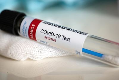 Cradock, Middelburg: 3 more Covid-19-related deaths 