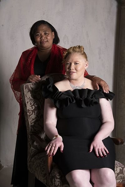 Albinism: A parent’s perspective 
