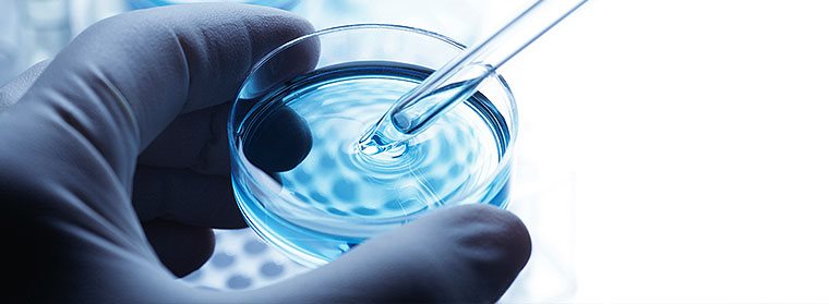 control of legionella in water systems