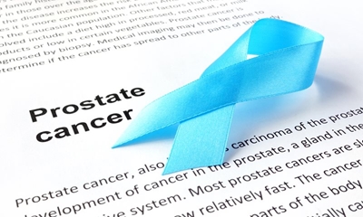 What you need to know about prostate cancer