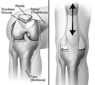 Patellofemoral pain syndrome