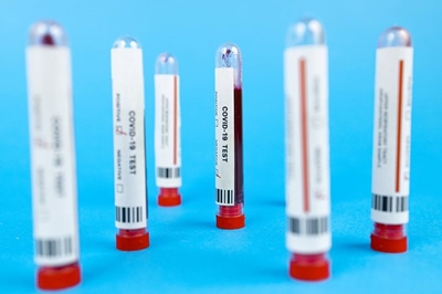 Covid-19 update: SA records 5,644 new cases