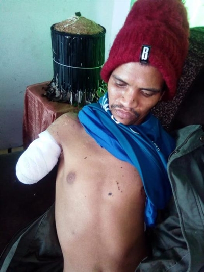 Jongman verloor arm ná honde-aanval