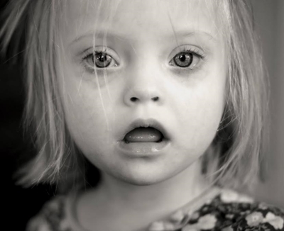 Five things to know about Down syndrome