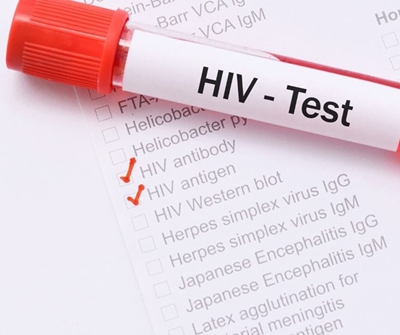 PrEp ‘safe for pregnant women living with HIV’
