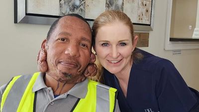 ‘n Nuwe voorkoms: Melvin se groeisels onder die mes   