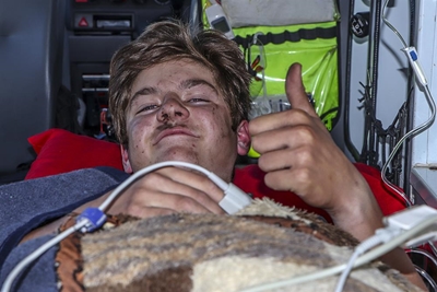 Jong fietsryers hou kop na beenbreuk