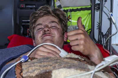 Jong fietsryers hou kop na beenbreuk