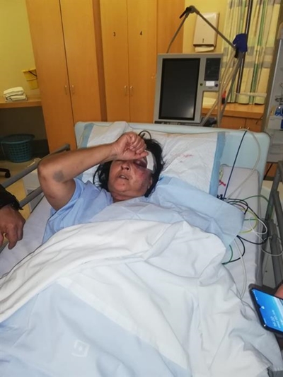 Plett volatile after  violent protests