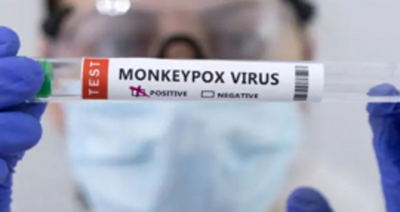 Be vigilant of monkeypox: SAMA
