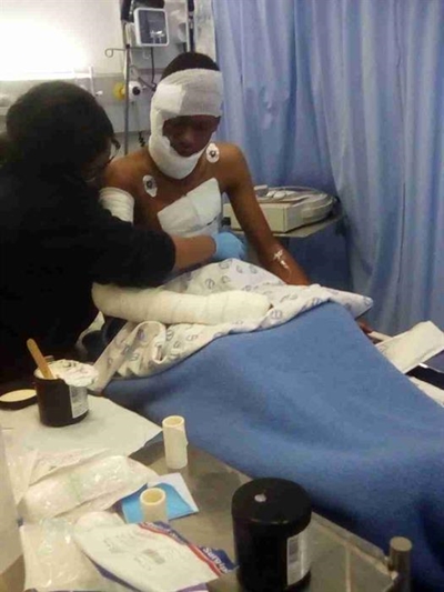 Boy in bad state after electrical explosion