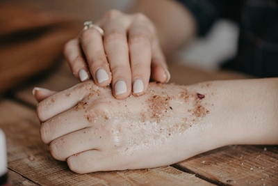 The true burden of eczema goes beyond the itch
