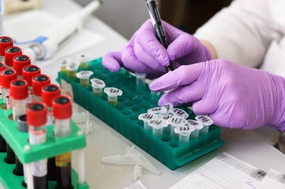 HIV is still a big threat in Africa