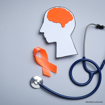 South Africa’s silent struggle with multiple sclerosis  