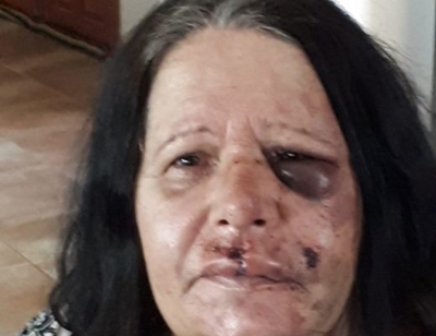 Vrou deur inbreker aangeval en verniel
