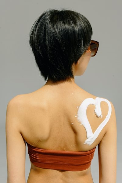 Beat the ‘ugly’: Tips to deal with common summer skin conditions