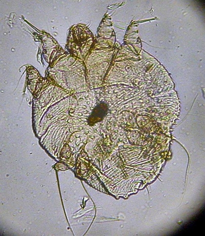 Scabies-voorvalle vermeerder 