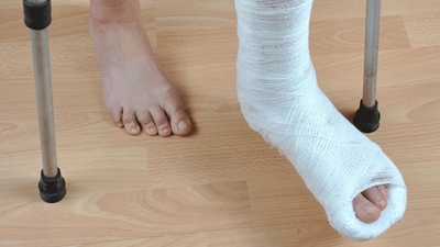 Signs and symptoms of fractures