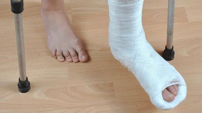 Signs and symptoms of fractures