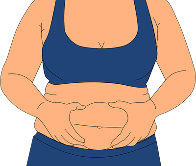 Obesity: Administering medication and monitoring conditions